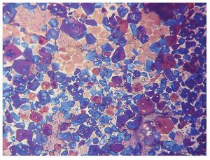 Figure 5: A microscopic image of a clinker shows the various mineral phases (blue equals alite and brown is belite).